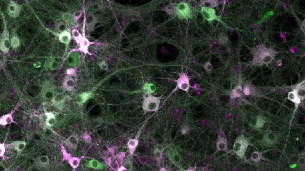 Investigating kinase activity in living cells