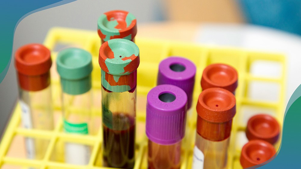 Finding a clue to the origin of treatment-resistant leukaemia in kids