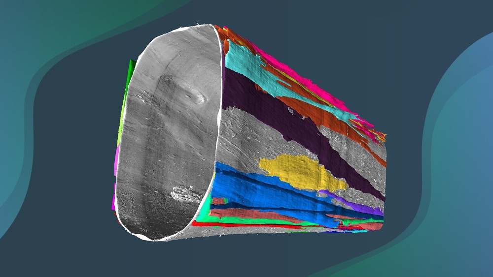 The hidden life of pericytes: understanding how cerebral malaria breaks the blood-brain barrier