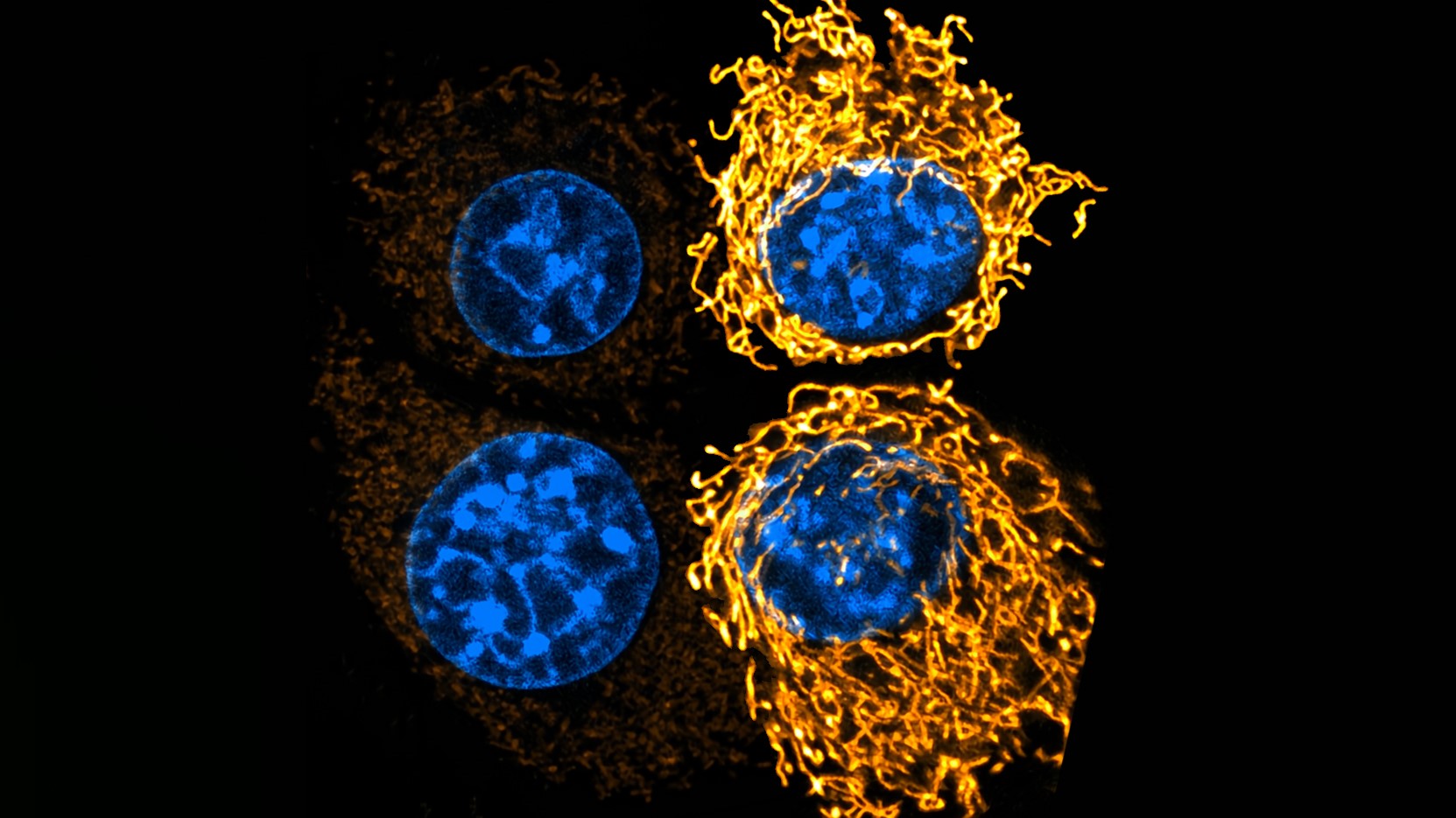 Acidic tumor environment promotes survival and growth of cancer cells