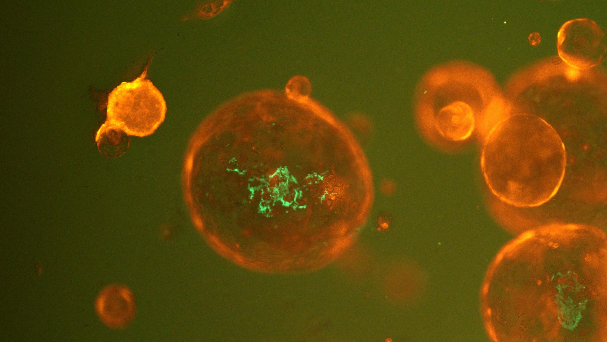 Universität Heidelberg: New DFG Research Unit in Oncology