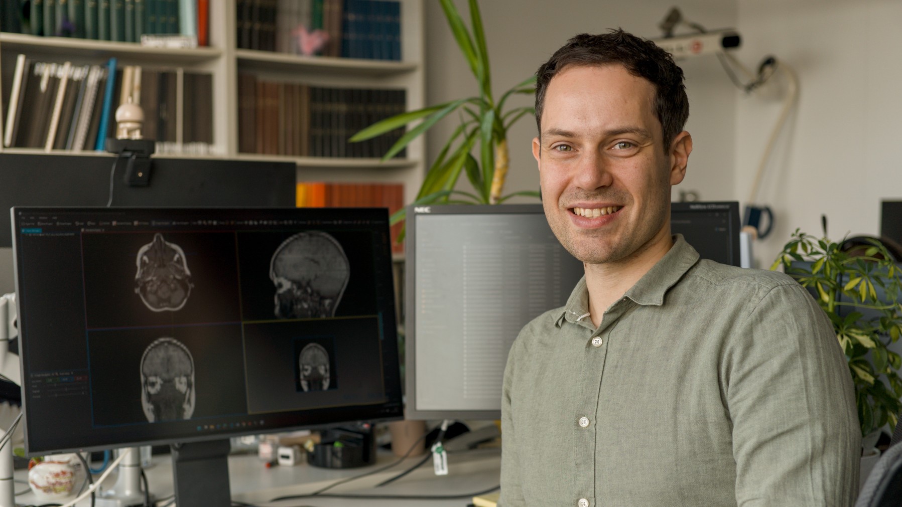 Cystic fibrosis research: AI-assisted evaluation of MRI images in chronic rhinosinusitis