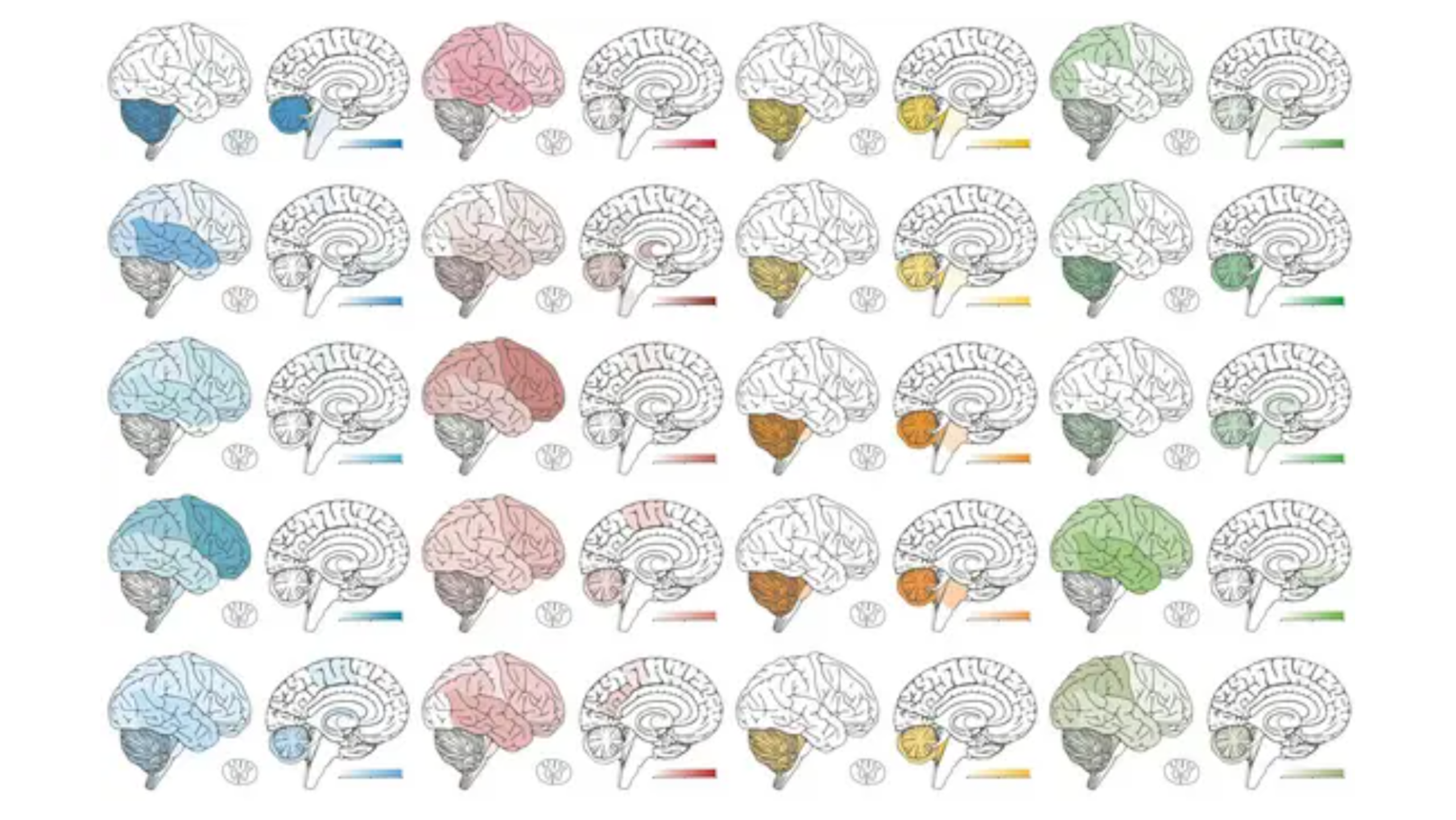 AI-supported molecular cancer diagnosis for brain tumors
