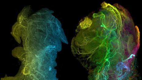 Nature Magazin featured HI-STEM publication on cancer neuroscience in Outlook article