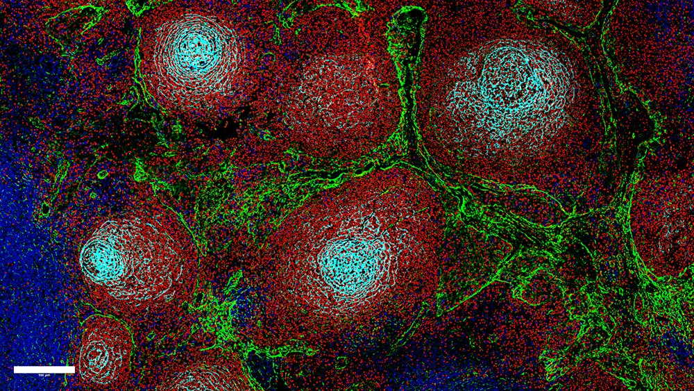 Study shows how lymph node architecture affects cancer growth