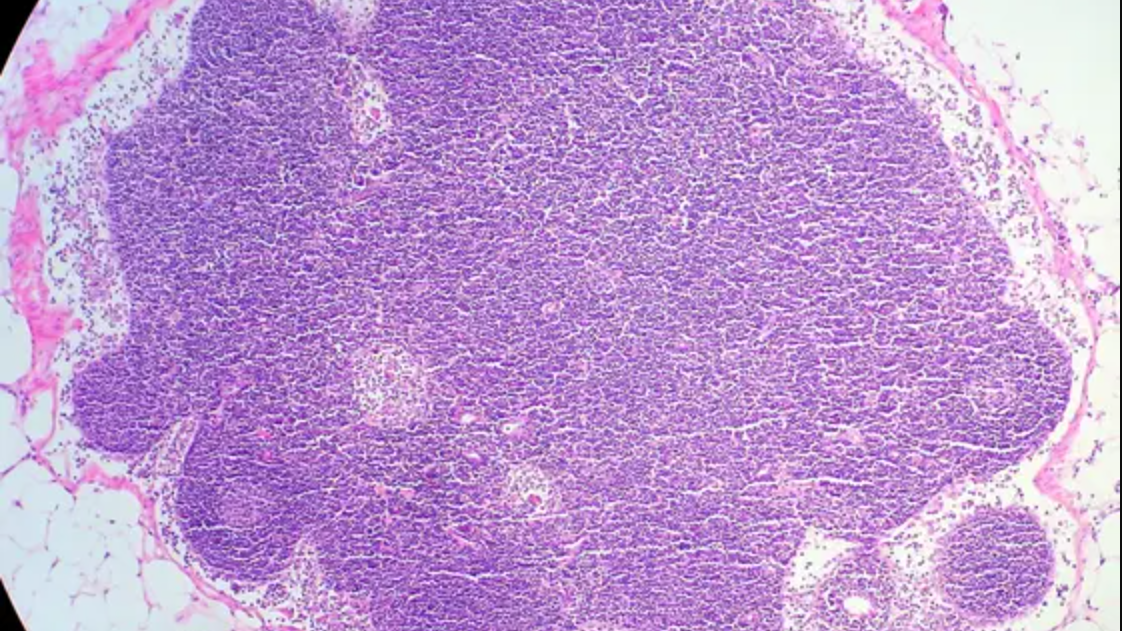 The Influence of Lymph Node Architecture on Lymphoma