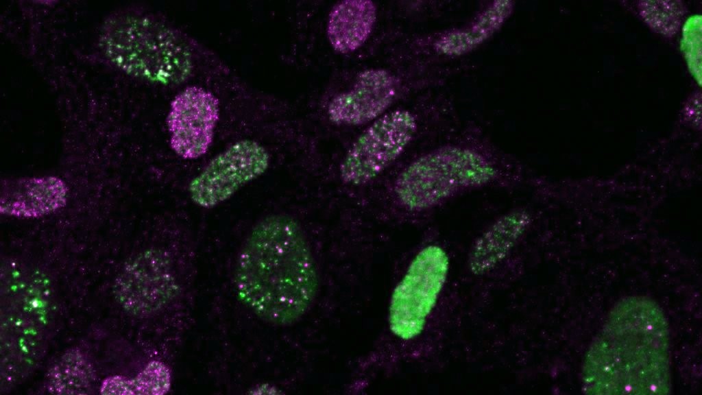 New Emmy Noether Junior Research Group Investigates the Mode of Action of Antimetabolite Chemotherapy