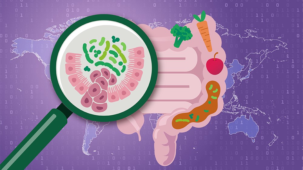 Large-scale microbiome study identifies robust colorectal cancer signature
