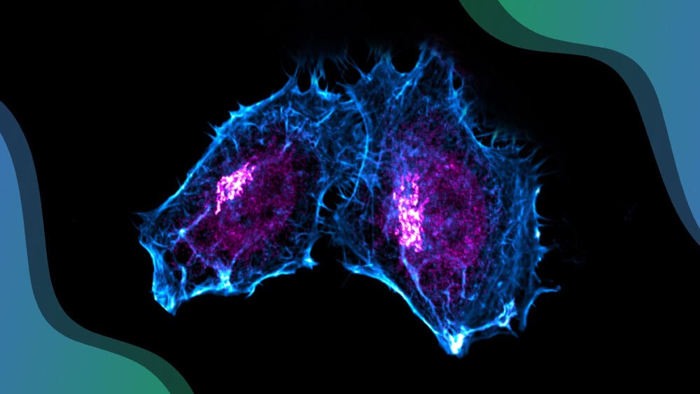 New research shows the Golgi complex is involved in DNA repair control