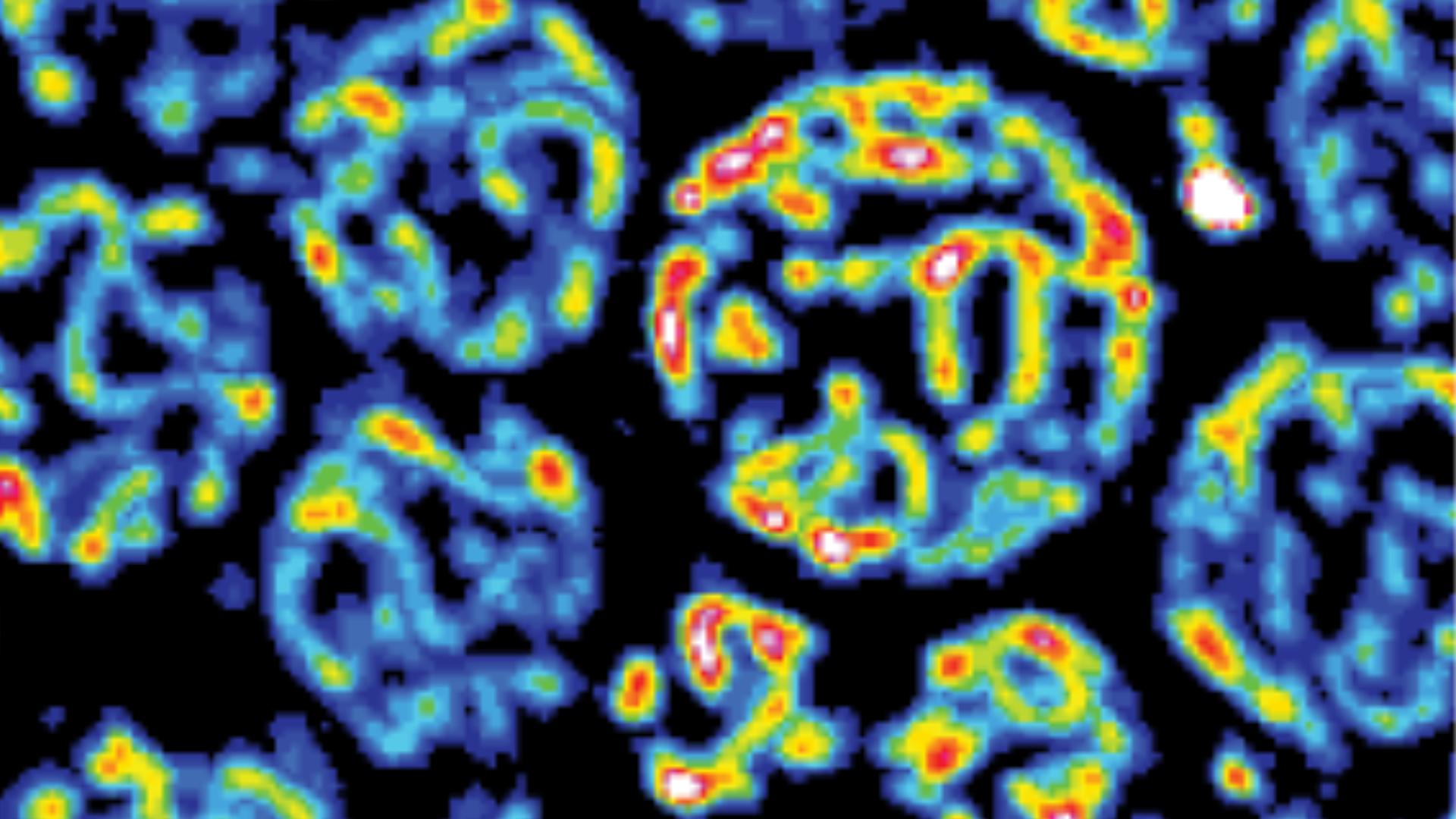 Cells Have an Early-Warning System for Stress in Mitochondria
